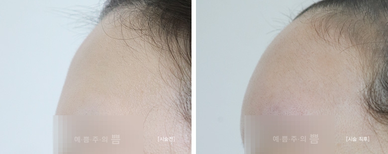 홍대점_이마큐오필